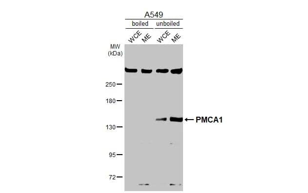 Boiled and unboiled A549 whole cell and membrane extracts (30 ug) were separated by 5% SDS-PAGE, and the membrane was blotted with PMCA1 antibody (NBP3-12964) diluted at 1:1000. The HRP-conjugated anti-rabbit IgG antibody  was used to detect the primary antibody. (WCE: whole cell extract; ME: membrane extract) 