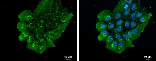 NUCB2 antibody detects NUCB2 protein at endoplasmic reticulum by immunofluorescent analysis.Sample: A431 cells were fixed in 4% paraformaldehyde at RT for 15 min.Green: NUCB2 protein stained by NUCB2 antibody (NBP3-12972) diluted at 1:500.Blue: Hoechst 33342 staining.Scale bar = 10 um. 