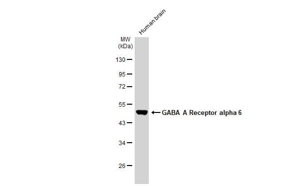 Human tissue extract (30 ug) was separated by 10% SDS-PAGE, and the membrane was blotted with GABA A Receptor alpha 6 antibody (NBP3-12973) diluted at 1:2000. The HRP-conjugated anti-rabbit IgG antibody  was used to detect the primary antibody. 