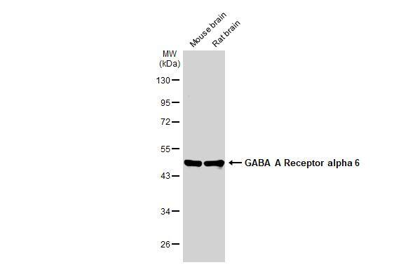Various tissue extracts (50 ug) were separated by 10% SDS-PAGE, and the membrane was blotted with GABA A Receptor alpha 6 antibody (NBP3-12973) diluted at 1:1000. The HRP-conjugated anti-rabbit IgG antibody  was used to detect the primary antibody. 