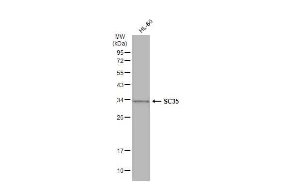 Various whole cell extracts (30 ug) were separated by 12% SDS-PAGE, and the membrane was blotted with SC35 antibody (NBP3-12974) diluted at 1:1000. The HRP-conjugated anti-rabbit IgG antibody  was used to detect the primary antibody. 