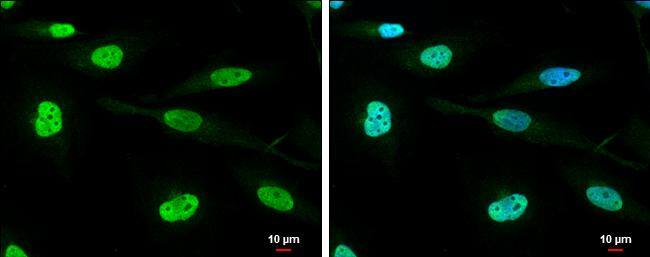 DHX9 antibody detects DHX9 protein at nucleus by immunofluorescent analysis.Sample: HeLa cells were fixed in 4% paraformaldehyde at RT for 15 min.Green: DHX9 protein stained by DHX9 antibody (NBP3-12975) diluted at 1:500.Blue: Hoechst 33342 staining.Scale bar = 10 um. 