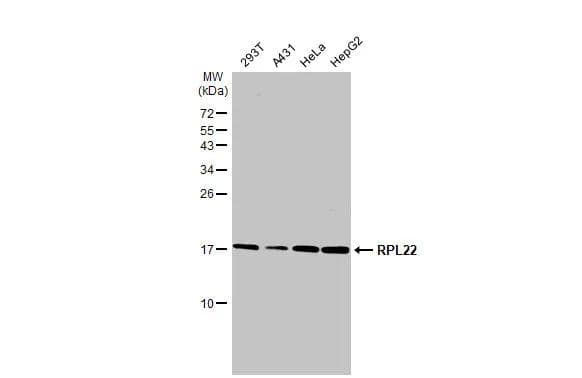 Various whole cell extracts (30 ug) were separated by 15% SDS-PAGE, and the membrane was blotted with RPL22 antibody (NBP3-12976) diluted at 1:500. The HRP-conjugated anti-rabbit IgG antibody  was used to detect the primary antibody. 