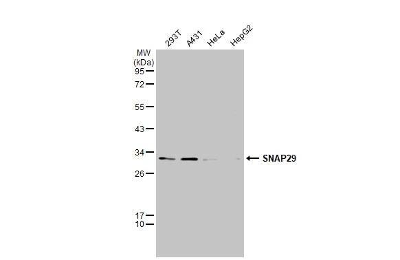 Various whole cell extracts (30 ug) were separated by 12% SDS-PAGE, and the membrane was blotted with SNAP29 antibody (NBP3-12979) diluted at 1:1000. The HRP-conjugated anti-rabbit IgG antibody  was used to detect the primary antibody. Corresponding RNA expression data for the same cell lines are based on Human Protein Atlas program. 