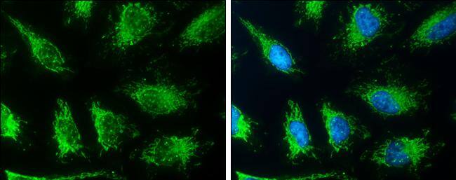 SLC19A2 antibody detects SLC19A2 protein at cytosol by immunofluorescent analysis.Sample: HeLa cells were fixed in 4% paraformaldehyde at RT for 15 min.Green: SLC19A2 protein stained by SLC19A2 antibody (NBP3-12981) diluted at 1:500.Blue: Hoechst 33342 staining. 