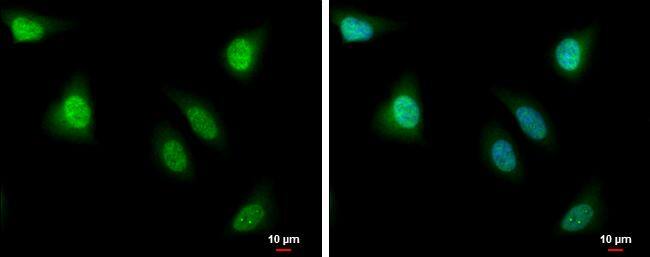 PBK antibody detects PBK protein at nucleus by immunofluorescent analysis.Sample: HeLa cells were fixed in 4% paraformaldehyde at RT for 15 min.Green: PBK protein stained by PBK antibody (NBP3-12989) diluted at 1:500.Blue: Hoechst 33342 staining.Scale bar = 10 um. 