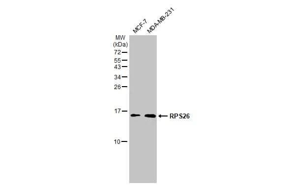 Various whole cell extracts (30 ug) were separated by 15% SDS-PAGE, and the membrane was blotted with RPS26 antibody (NBP3-13001) diluted at 1:500. The HRP-conjugated anti-rabbit IgG antibody  was used to detect the primary antibody. 
