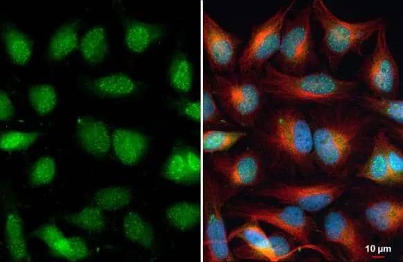ARID5B antibody detects ARID5B protein at nucleus by immunofluorescent analysis.Sample: HeLa cells were fixed in 4% paraformaldehyde at RT for 15 min.Green: ARID5B stained by ARID5B antibody (NBP3-13006) diluted at 1:500.Red: alpha Tubulin, a cytoskeleton marker, stained by alpha Tubulin antibody [GT114]  diluted at 1:1000.Blue: Fluoroshield with DAPI . 