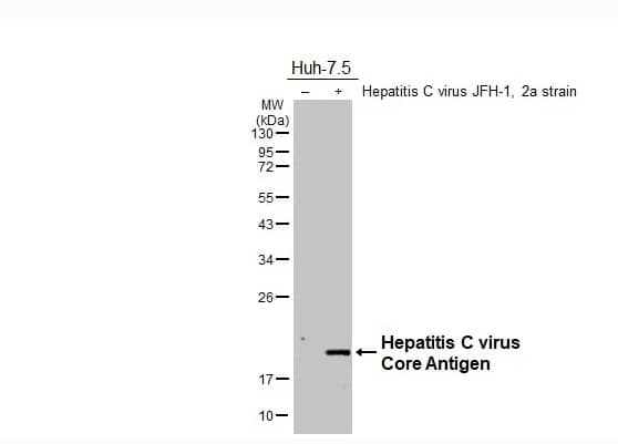Western Blot Hepatitis C Virus Core Antigen Antibody - BSA Free