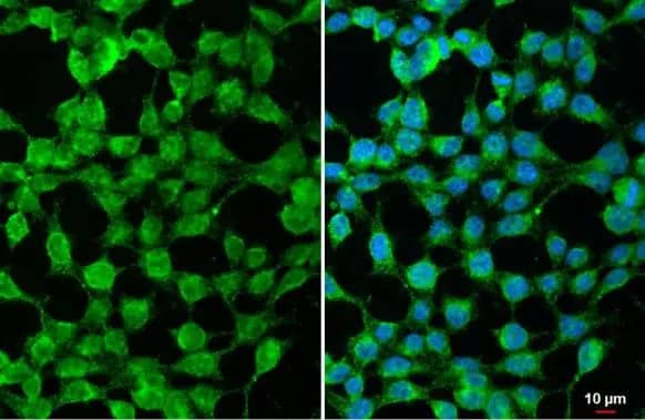 Immunocytochemistry/ Immunofluorescence: SARM1 Antibody [NBP3-13023] - SARM1 antibody detects SARM1 protein at cytoplasm and nucleus by immunofluorescent analysis.Sample: 293T cells were fixed in 4% paraformaldehyde at RT for 15 min.Green: SARM1 stained by SARM1 antibody (NBP3-13023) diluted at 1:500.Blue: Fluoroshield with DAPI .