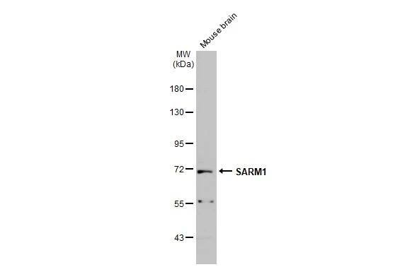 Mouse tissue extract (50 ug) was separated by 7.5% SDS-PAGE, and the membrane was blotted with SARM1 antibody (NBP3-13023) diluted at 1:1000. The HRP-conjugated anti-rabbit IgG antibody  was used to detect the primary antibody. 