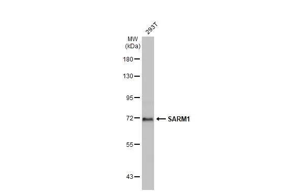 Whole cell extract (30 ug) was separated by 7.5% SDS-PAGE, and the membrane was blotted with SARM1 antibody (NBP3-13023) diluted at 1:1000. The HRP-conjugated anti-rabbit IgG antibody  was used to detect the primary antibody. 