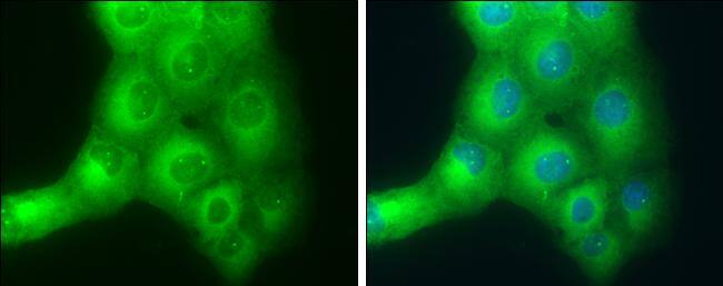 Immunocytochemistry/ Immunofluorescence SLK Antibody - BSA Free
