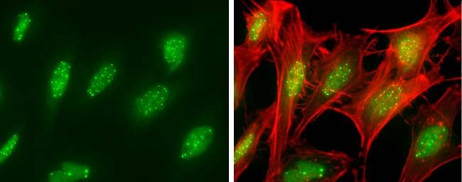 SP100 antibody detects SP100 protein at nucleus by immunofluorescent analysis.Sample: HeLa cells were fixed in 4% paraformaldehyde at RT for 15 min.Green: SP100 protein stained by SP100 antibody (NBP3-13031) diluted at 1:500.Red: phalloidin, a cytoskeleton marker, diluted at 1:100. 