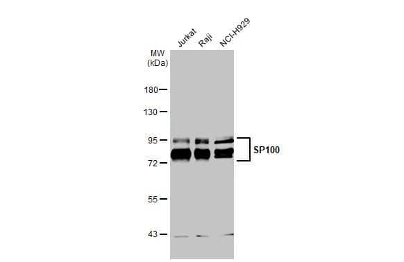 Various whole cell extracts (30 ug) were separated by 7.5% SDS-PAGE, and the membrane was blotted with SP100 antibody (NBP3-13031) diluted at 1:1000. The HRP-conjugated anti-rabbit IgG antibody  was used to detect the primary antibody. 