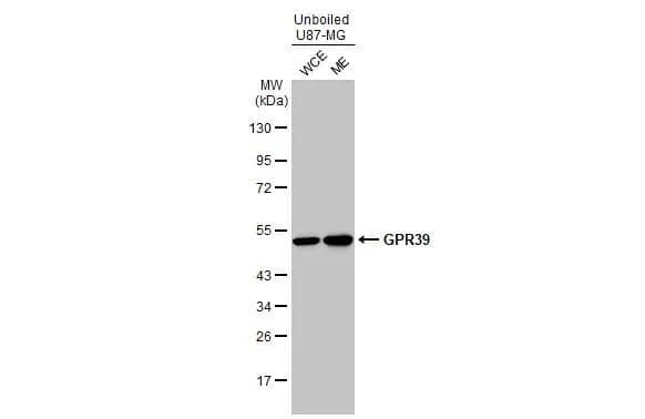 Unboiled U87-MG whole cell and membrane extracts (30 ug) were separated by 10% SDS-PAGE, and the membrane was blotted with GPR39 antibody (NBP3-13032) diluted at 1:1000. The HRP-conjugated anti-rabbit IgG antibody  was used to detect the primary antibody. 