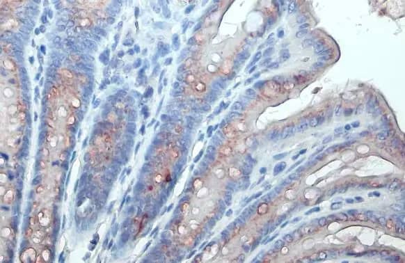 Immunohistochemistry-Paraffin: Polypeptide GalNac Transferase 3/GALNT3 Antibody [NBP3-13034] - Polypeptide GalNac Transferase 3/GALNT3 antibody detects Polypeptide GalNac Transferase 3/GALNT3 protein at Golgi apparatus by immunohistochemical analysis.Sample: Paraffin-embedded mouse colon.Polypeptide GalNac Transferase 3/GALNT3 stained by Polypeptide GalNac Transferase 3/GALNT3 antibody (NBP3-13034) diluted at 1:500.Antigen Retrieval: Citrate buffer, pH 6.0, 15 min