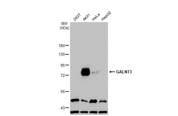 Western Blot: Polypeptide GalNac Transferase 3/GALNT3 Antibody [NBP3-13034] - Various whole cell extracts (30 ug) were separated by 7.5% SDS-PAGE, and the membrane was blotted with Polypeptide GalNac Transferase 3/GALNT3 antibody (NBP3-13034) diluted at 1:1000. The HRP-conjugated anti-rabbit IgG antibody  was used to detect the primary antibody.