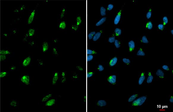 Immunocytochemistry/ Immunofluorescence: Polypeptide GalNac Transferase 3/GALNT3 Antibody [NBP3-13034] - Polypeptide GalNac Transferase 3/GALNT3 antibody detects Polypeptide GalNac Transferase 3/GALNT3 protein at Golgi by immunofluorescent analysis.Sample: HeLa cells were fixed in 4% paraformaldehyde at RT for 15 min.Green: Polypeptide GalNac Transferase 3/GALNT3 stained by Polypeptide GalNac Transferase 3/GALNT3 antibody (NBP3-13034) diluted at 1:3000.Blue: Fluoroshield with DAPI .