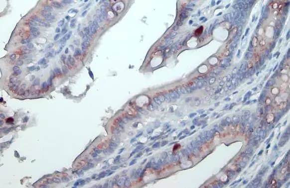 Immunohistochemistry-Paraffin: Polypeptide GalNac Transferase 3/GALNT3 Antibody [NBP3-13034] - Polypeptide GalNac Transferase 3/GALNT3 antibody detects Polypeptide GalNac Transferase 3/GALNT3 protein at Golgi apparatus by immunohistochemical analysis.Sample: Paraffin-embedded mouse colon.Polypeptide GalNac Transferase 3/GALNT3 stained by Polypeptide GalNac Transferase 3/GALNT3 antibody (NBP3-13034) diluted at 1:500.Antigen Retrieval: Citrate buffer, pH 6.0, 15 min