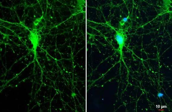 SYNGAP1 antibody detects SYNGAP1 protein at Synapse by immunofluorescent analysis.Sample: DIV10 rat hippocampal neuron cells were fixed in 4% paraformaldehyde at RT for 15 min.Green: SYNGAP1 stained by SYNGAP1 antibody (NBP3-13035) diluted at 1:500.Red: Tau, a marker, stained by Tau antibody [GT287]  diluted at 1:500. 