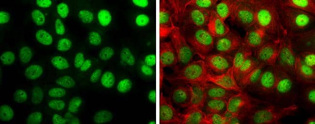 TIF1 gamma antibody detects TIF1 gamma protein at nucleus by immunofluorescent analysis.Sample: MCF-7 cells were fixed in 4% paraformaldehyde at RT for 15 min.Green: TIF1 gamma stained by TIF1 gamma antibody (NBP3-13036) diluted at 1:2000.Red: alpha Tubulin, a cytoskeleton marker, stained by alpha Tubulin antibody [GT114]  diluted at 1:500. 