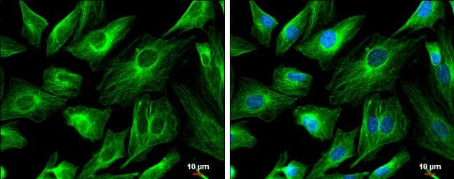 Immunocytochemistry/ Immunofluorescence FSD1 Antibody - BSA Free