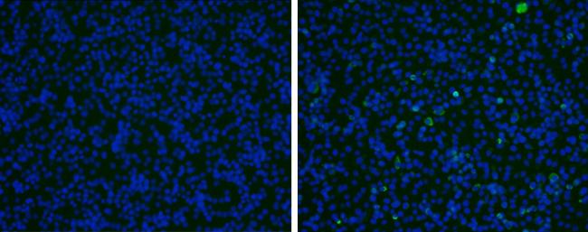 prM protein (Japanese encephalitis virus) antibody detects prM protein (Japanese encephalitis virus) by immunofluorescence analysis.Samples: BHK-21 cells mock (left) and infected with Japanese encephalitis virus (right) were fixed in methanol/acetone.Green: prM protein (Japanese encephalitis virus) stained by prM protein (Japanese encephalitis virus) antibody (NBP3-13043) diluted at 1:1000.Blue: Hoechst 33342 staining. 