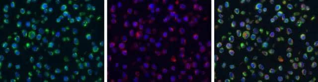 Dengue virus NS4A protein antibody detects Dengue virus NS4A protein protein at cytoplasm by immunohistochemical analysis.Sample: Paraffin-embedded BHK-21 infected with dengue virus.Green: Dengue virus NS4A protein stained by Dengue virus NS4A protein antibody (NBP3-13063) diluted at 1:1000.Red: alpha Tubulin, a cytoskeleton marker, stained by alpha Tubulin antibody [GT114]  diluted at 1:1000.Blue: Fluoroshield with DAPI .Antigen Retrieval: Citrate buffer, pH 6.0, 15 min 