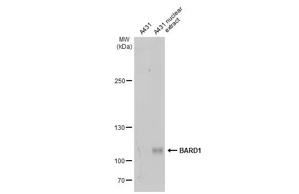 Western Blot: BARD1 Antibody [NBP3-13065] - A431 whole cell and nuclear extracts (30 ug) were separated by 5% SDS-PAGE, and the membrane was blotted with BARD1 antibody (NBP3-13065) diluted at 1:1000. The HRP-conjugated anti-rabbit IgG antibody  was used to detect the primary antibody.