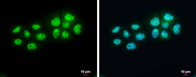 BARD1 antibody detects BARD1 protein at nucleus by immunofluorescent analysis.Sample: A431 cells were fixed in 4% paraformaldehyde at RT for 15 min.Green: BARD1 protein stained by BARD1 antibody (NBP3-13065) diluted at 1:500.Blue: Hoechst 33342 staining.Scale bar = 10 um. 
