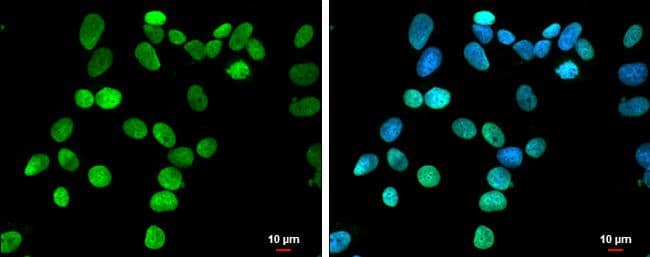 HMGA1 antibody detects HMGA1 protein at nucleus by immunofluorescent analysis.Sample: MCF7 cells were fixed in 4% paraformaldehyde at RT for 15 min.Green: HMGA1 protein stained by HMGA1 antibody (NBP3-13068) diluted at 1:500.Blue: Hoechst 33342 staining.Scale bar = 10 um. 