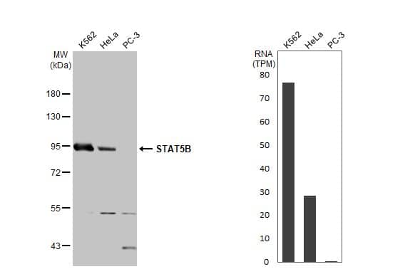 <b>Orthogonal Strategies Validation. </b>Western Blot: STAT5b Antibody [NBP3-13069] - Various whole cell extracts (30 ug) were separated by 7.5% SDS-PAGE, and the membrane was blotted with STAT5B antibody  diluted at 1:1000. The HRP-conjugated anti-rabbit IgG antibody  was used to detect the primary antibody.