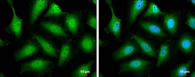 STAT5B antibody detects STAT5B protein at cytoplasm and nucleus by immunofluorescent analysis.Sample: HeLa cells were fixed in 4% paraformaldehyde at RT for 15 min.Green: STAT5B protein stained by STAT5B antibody (NBP3-13069) diluted at 1:500.Blue: Hoechst 33342 staining.Scale bar = 10 um. 