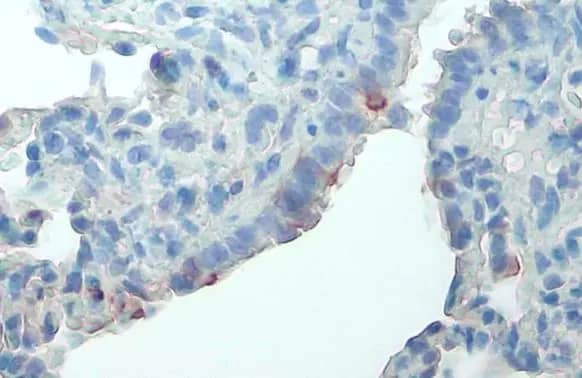 Immunohistochemistry-Paraffin: FAK [p Tyr576] Antibody [NBP3-13071] - FAK antibody detects FAK protein at cell membrane by immunohistochemical analysis.Sample: Paraffin-embedded rat lung.FAK stained by FAK antibody (NBP3-13071) diluted at 1:500.Antigen Retrieval: Citrate buffer, pH 6.0, 15 min