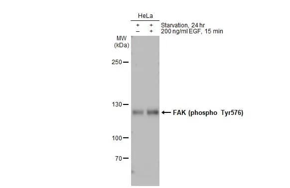 Western Blot: FAK [p Tyr576] Antibody [NBP3-13071] - Untreated (-) and treated (+) HeLa whole cell extracts (30 ug) were separated by 5% SDS-PAGE, and the membrane was blotted with FAK antibody (NBP3-13071) diluted at 1:500. The HRP-conjugated anti-rabbit IgG antibody  was used to detect the primary antibody.