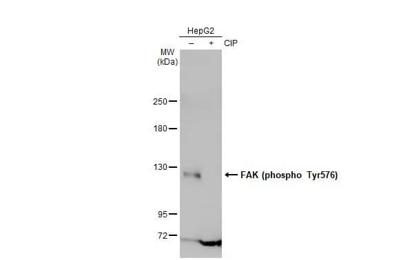 Western Blot: FAK [p Tyr576] Antibody [NBP3-13071] - Untreated (-) and treated (+) HepG2 whole cell extracts (30 ug) were separated by 5% SDS-PAGE, and the membrane was blotted with FAK antibody (NBP3-13071) diluted at 1:500. The HRP-conjugated anti-rabbit IgG antibody  was used to detect the primary antibody.