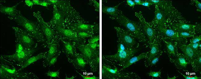 FAK (phospho Tyr576) antibody detects FAK (phospho Tyr576) protein at cell membrane and nucleus by immunofluorescent analysis.Sample: SK-N-SH cells were fixed in 4% paraformaldehyde at RT for 15 min.Green: FAK (phospho Tyr576) protein stained by FAK (phospho Tyr576) antibody (NBP3-13071) diluted at 1:500.Blue: Hoechst 33342 staining.Scale bar = 10 um. 