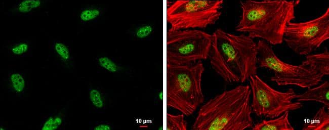 Rad17 (phospho Ser656) antibody detects Rad17 (phospho Ser656) protein at nucleus by immunofluorescent analysis.Sample: HeLa cells were fixed in 4% paraformaldehyde at RT for 15 min.Green: Rad17 (phospho Ser656) protein stained by Rad17 (phospho Ser656) antibody (NBP3-13072) diluted at 1:500.Red: phalloidin, a cytoskeleton marker, diluted at 1:200.Scale bar = 10 um. 