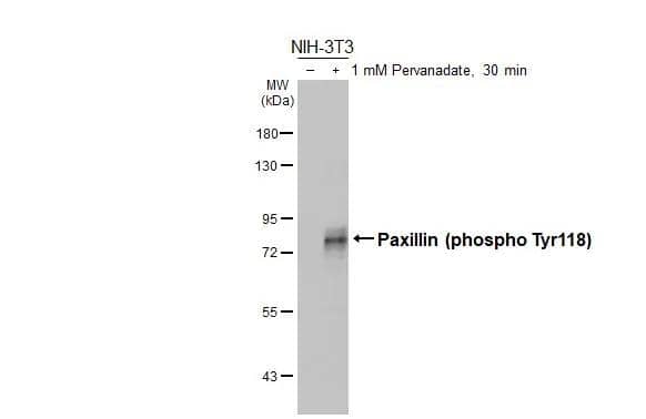 Untreated (-) and treated (+) NIH-3T3 whole cell extracts were separated by 7.5% SDS-PAGE, and the membrane was blotted with Paxillin (phospho Tyr118) antibody (NBP3-13073) diluted at 1:50000. The HRP-conjugated anti-rabbit IgG antibody  was used to detect the primary antibody. 