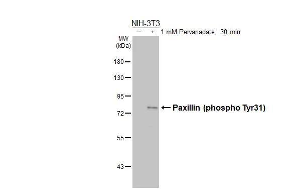 Untreated (-) and treated (+) NIH-3T3 whole cell extracts (30 ug) were separated by 7.5% SDS-PAGE, and the membrane was blotted with Paxillin (phospho Tyr31) antibody (NBP3-13074) diluted at 1:1000. The HRP-conjugated anti-rabbit IgG antibody  was used to detect the primary antibody. 
