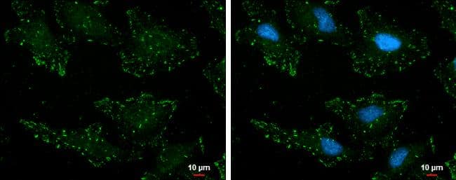 p130Cas (phospho Tyr165) antibody detects p130Cas (phospho Tyr165) protein at cell junction by immunofluorescent analysis.Sample: HeLa cells were fixed in ice-cold MeOH for 5 min.Green: p130Cas (phospho Tyr165) protein stained by p130Cas (phospho Tyr165) antibody (NBP3-13075) diluted at 1:500.Blue: Hoechst 33342 staining.Scale bar = 10 um. 