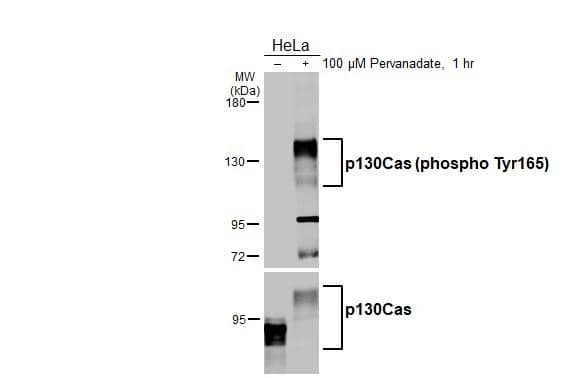 Untreated (-) and treated (+) HeLa whole cell extracts (30 ug) were separated by 5% SDS-PAGE, and the membrane was blotted with p130Cas (phospho Tyr165) antibody (NBP3-13075) diluted at 1:10000. The HRP-conjugated anti-rabbit IgG antibody  was used to detect the primary antibody. 