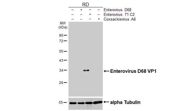 Non-infected (-) and infected (+) RD whole cell extracts (5 ug) were separated by 12% SDS-PAGE, and the membrane was blotted with Enterovirus D68 VP1 antibody (NBP3-13081) diluted at 1:1000. The HRP-conjugated anti-rabbit IgG antibody  was used to detect the primary antibody. 