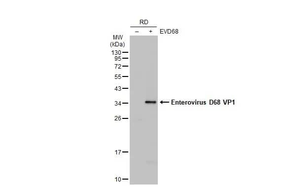 Western Blot: Enterovirus D68 VP1 Antibody [NBP3-13082] - Non-infected (-) and infected (+) RD whole cell extracts (30 ug) were separated by 12% SDS-PAGE, and the membrane was blotted with Enterovirus D68 VP1 antibody (NBP3-13082) diluted at 1:1000. The HRP-conjugated anti-rabbit IgG antibody  was used to detect the primary antibody.