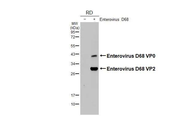Non-infected (-) and infected (+) RD whole cell extracts (5 ug) were separated by 12% SDS-PAGE, and the membrane was blotted with Enterovirus D68 VP2 antibody (NBP3-13083) diluted at 1:1000. The HRP-conjugated anti-rabbit IgG antibody  was used to detect the primary antibody. 