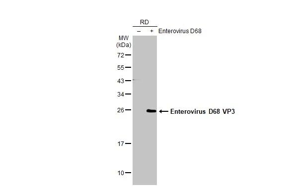 Non-infected (-) and infected (+) RD whole cell extracts were separated by 12% SDS-PAGE, and the membrane was blotted with EVD68 VP3 antibody (NBP3-13084) diluted at 1:1000. The HRP-conjugated anti-rabbit IgG antibody  was used to detect the primary antibody. 
