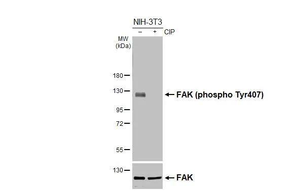 Untreated (-) and treated (+) NHI-3T3 whole cell extracts (30 ug) were separated by 7.5% SDS-PAGE, and the membranes were blotted with FAK (phospho Tyr407) antibody (NBP3-13085) diluted at 1:1000 and Fak antibody  diluted at 1:1000. The HRP-conjugated anti-rabbit IgG antibody  was used to detect the primary antibody. 