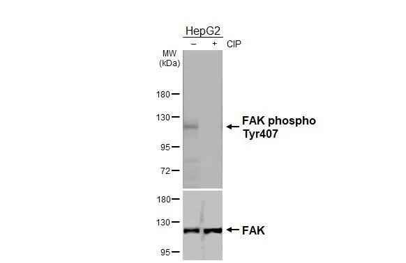 Untreated (-) and treated (+) HepG2 whole cell extracts (30 ug) were separated by 7.5% SDS-PAGE, and the membranes were blotted with FAK (phospho Tyr407) antibody (NBP3-13085) diluted at 1:1000 and FAK antibody diluted at 1:1000. The HRP-conjugated anti-rabbit IgG antibody  was used to detect the primary antibody. 