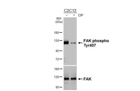 Untreated (-) and treated (+) C2C12 whole cell extracts (30 ug) were separated by 7.5% SDS-PAGE, and the membranes were blotted with FAK (phospho Tyr407) antibody (NBP3-13085) diluted at 1:1000 and FAK antibody diluted at 1:1000. The HRP-conjugated anti-rabbit IgG antibody  was used to detect the primary antibody. 